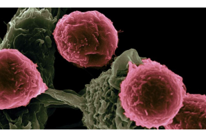 ¿Para qué tipos de cáncer se utiliza dostarlimab ? El único resumen que necesita.