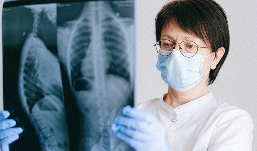 Nuevos tratamientos para el cáncer de pulmón 2022