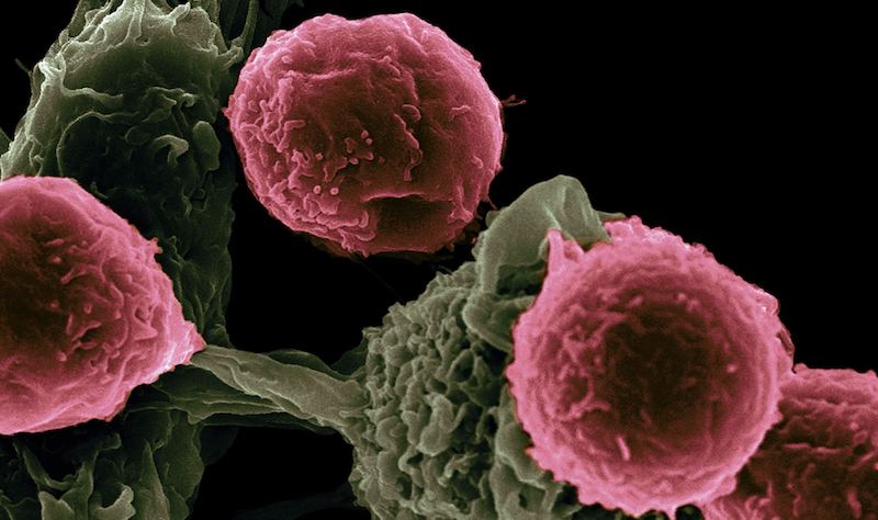 ¿Para qué tipos de cáncer se utiliza dostarlimab ? El único resumen que necesita.