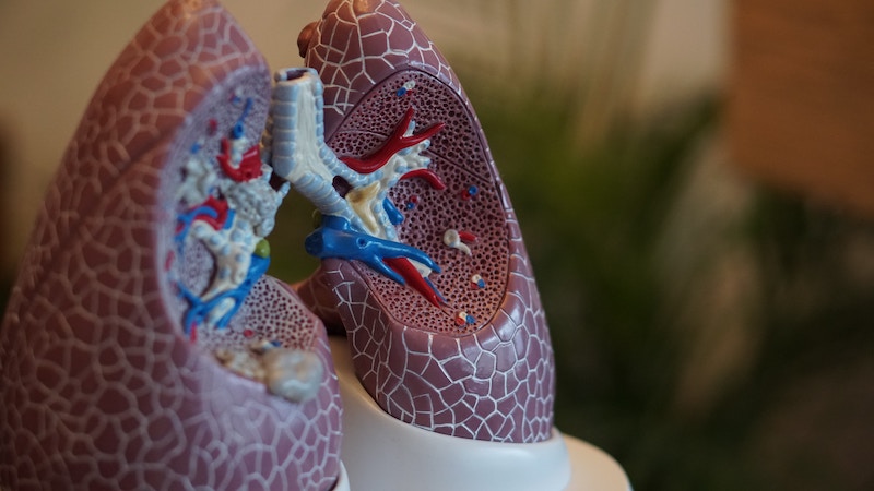 Fruquintinib como tratamiento del cáncer de pulmón: ¿Hemos llegado ya?